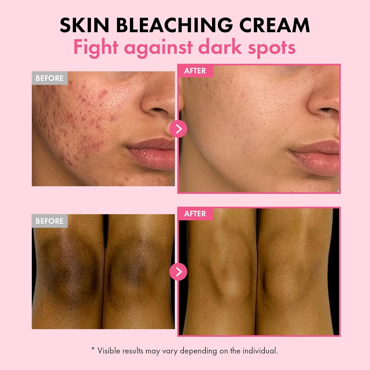 TOSOWOONG Dark Spot 35 Fade Cream, Dark Spot remover with Arbutin, Kojic Acid, Niacinamide, Skin Bleaching Cream for face & body Hyperpigmentation, Discoloration, Korean Skincare 50ml / 1.69 fl. oz.