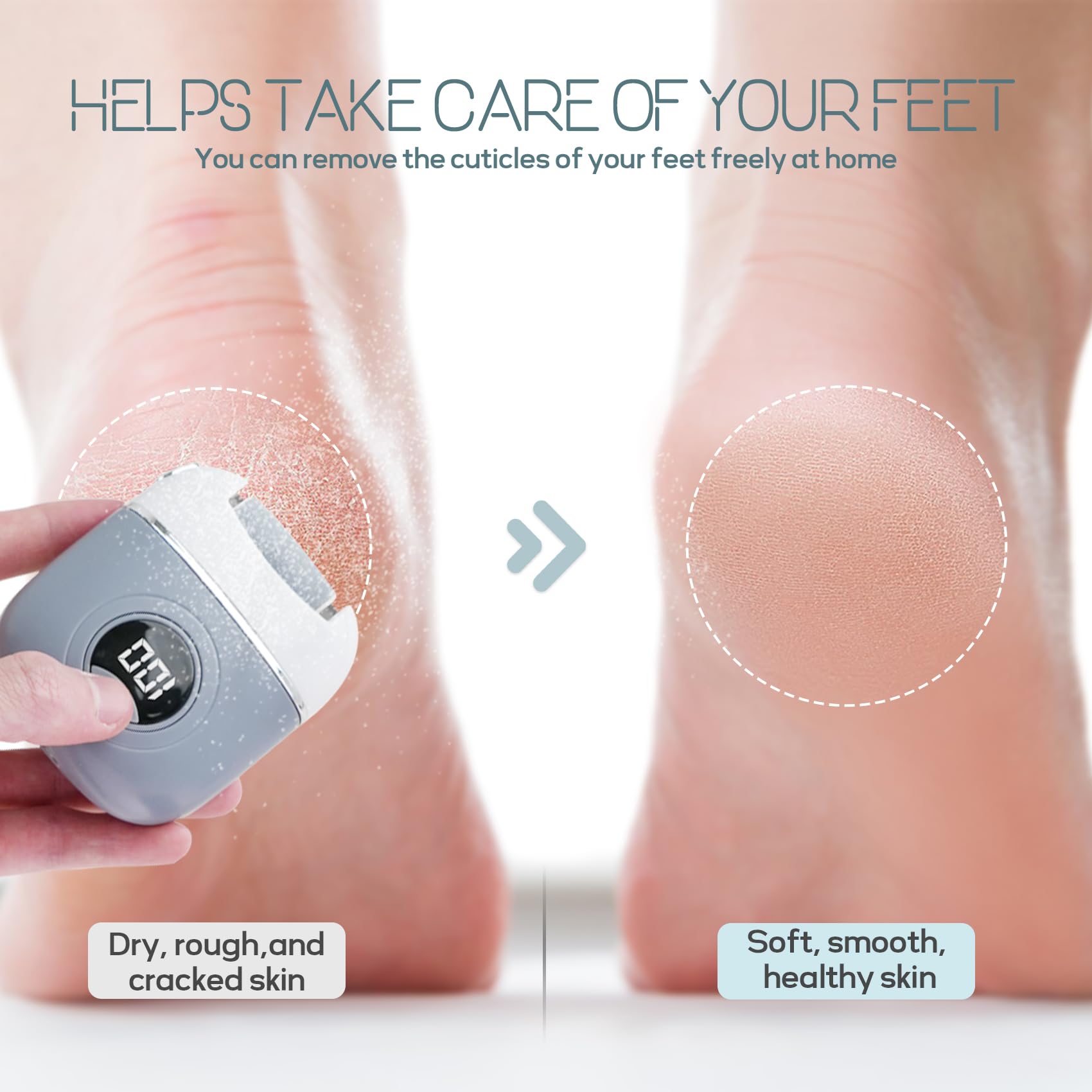 Strumento elettrico automatico per la rimozione dei calli, strumento per pedicure ricaricabile con 3 teste a rullo e 2 velocità, lima impermeabile per piedi per pelle morta, dura, screpolata e