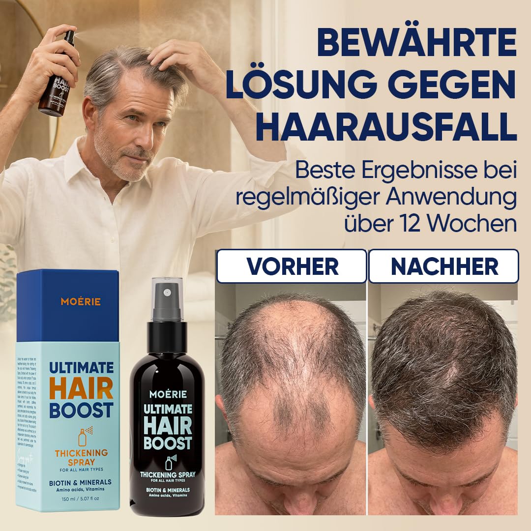 MOERIE Haarwachstum Serum Spray - natürlich Haarwachstum beschleunigen - Haarwuchsmittel Frauen & Männer - mit Mineralien, Caffein & Biotin Haare stärken - Haarvitamine gegen Haarausfall Frau