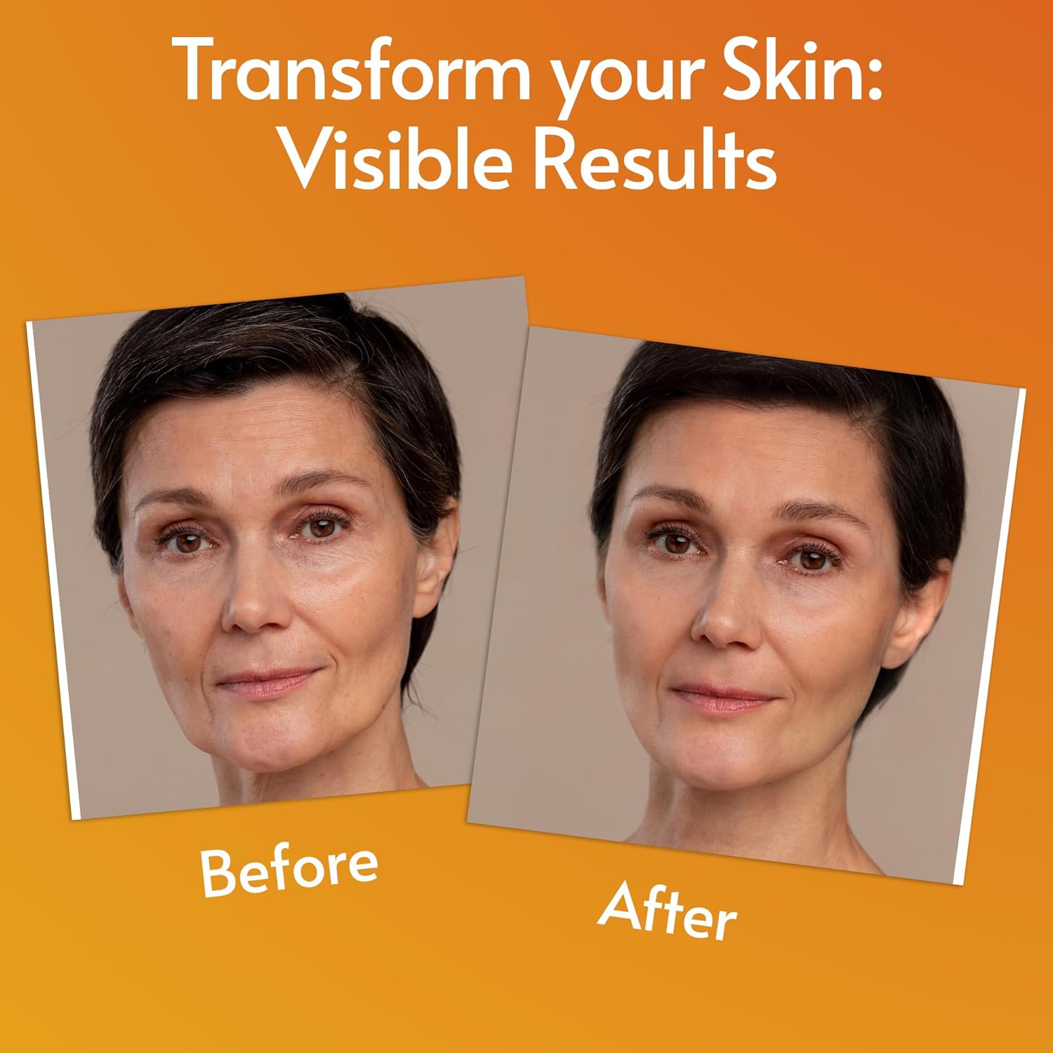 Sylk Vitamin C Serum For Face with Hyaluronic Acid & Vitamin E – Brightening Serum – Treatment for Anti Aging, Dark Spots, Tone, Fine Lines & Wrinkles - Microneedling - Korean Skincare - 2 fl oz - Image 8