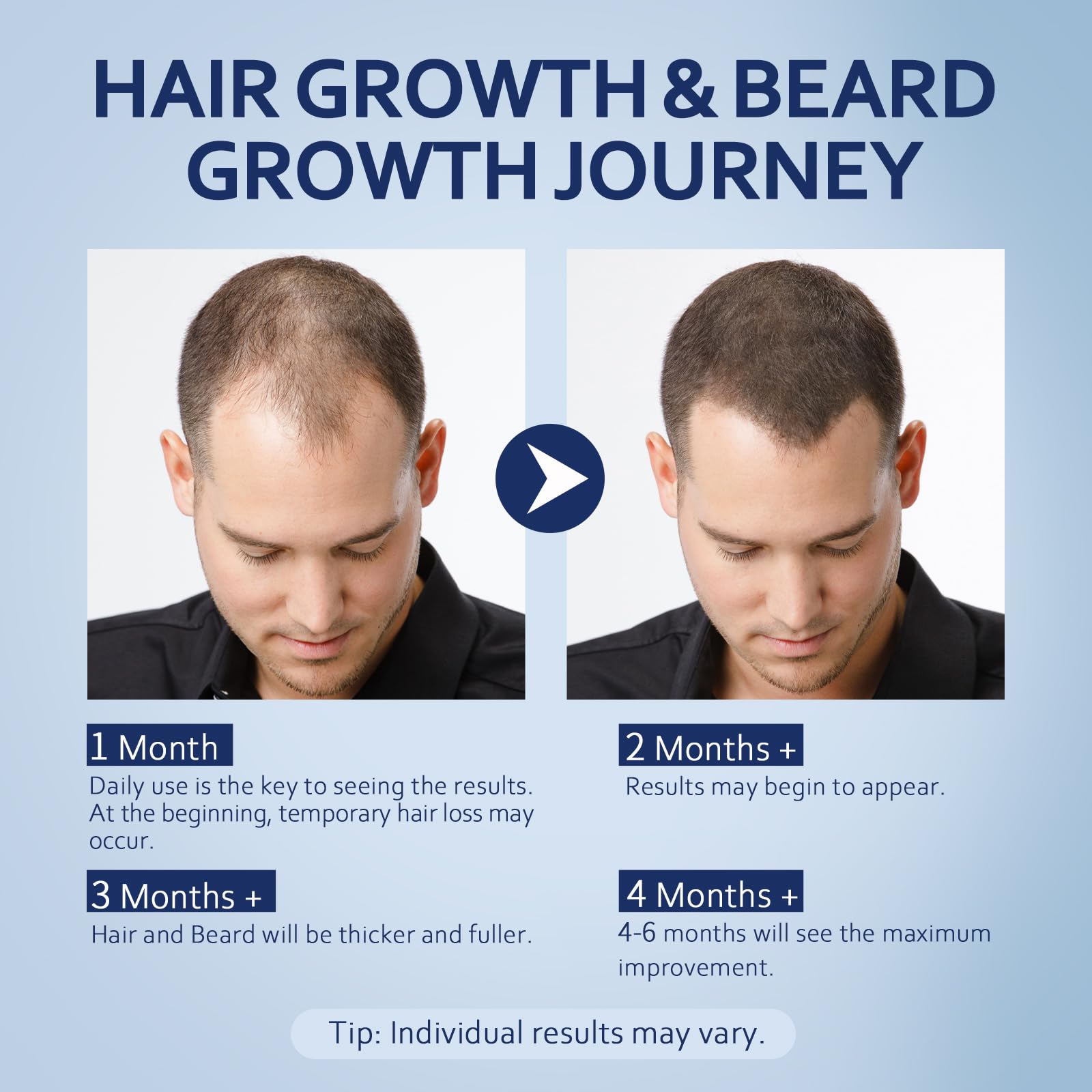 5% Minoxidil Hair Growth Serum with Biotin, Collagen & Castor Oil