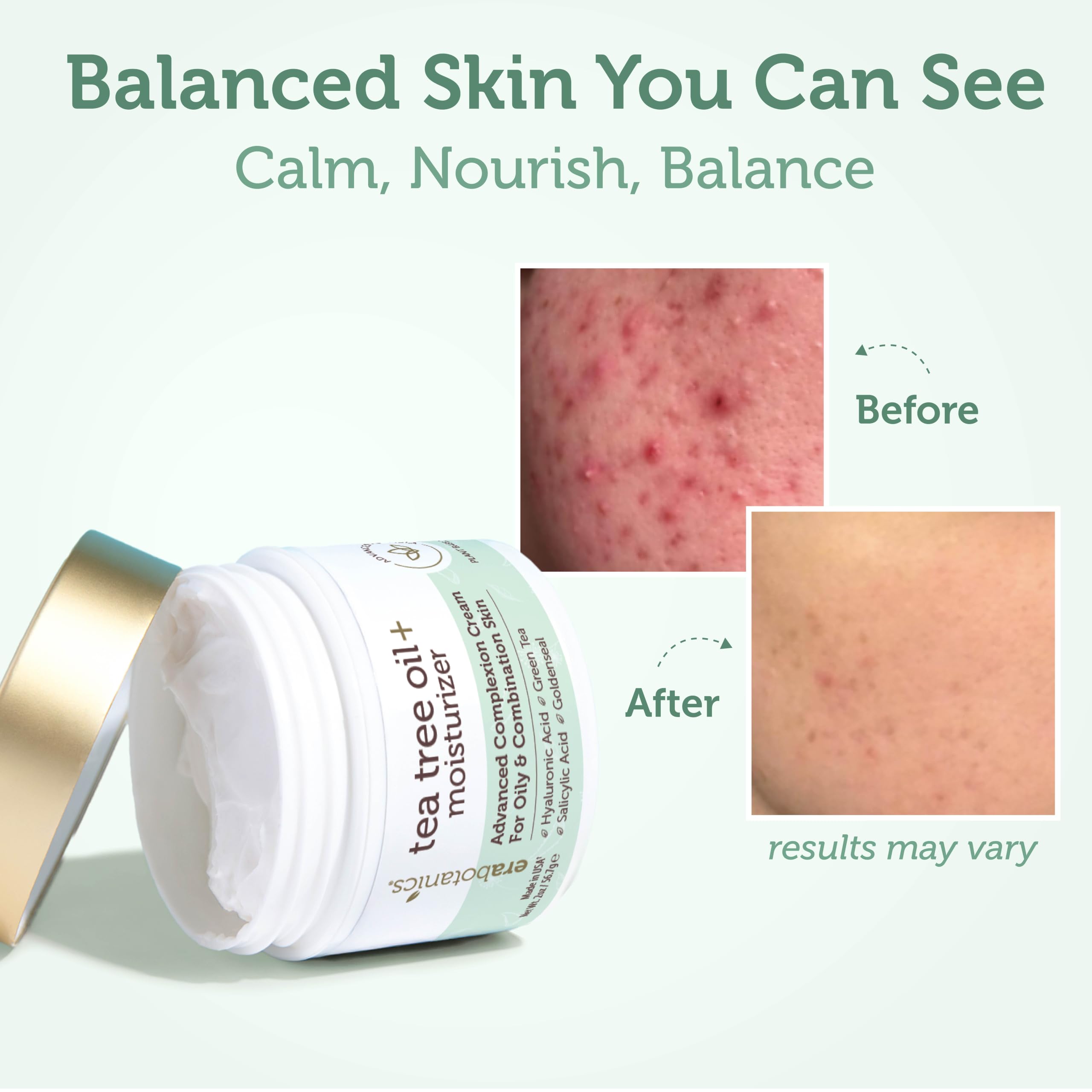 Amazon.com: Era Organics Tea Tree Oil Face Cream - Salicylic Acid
