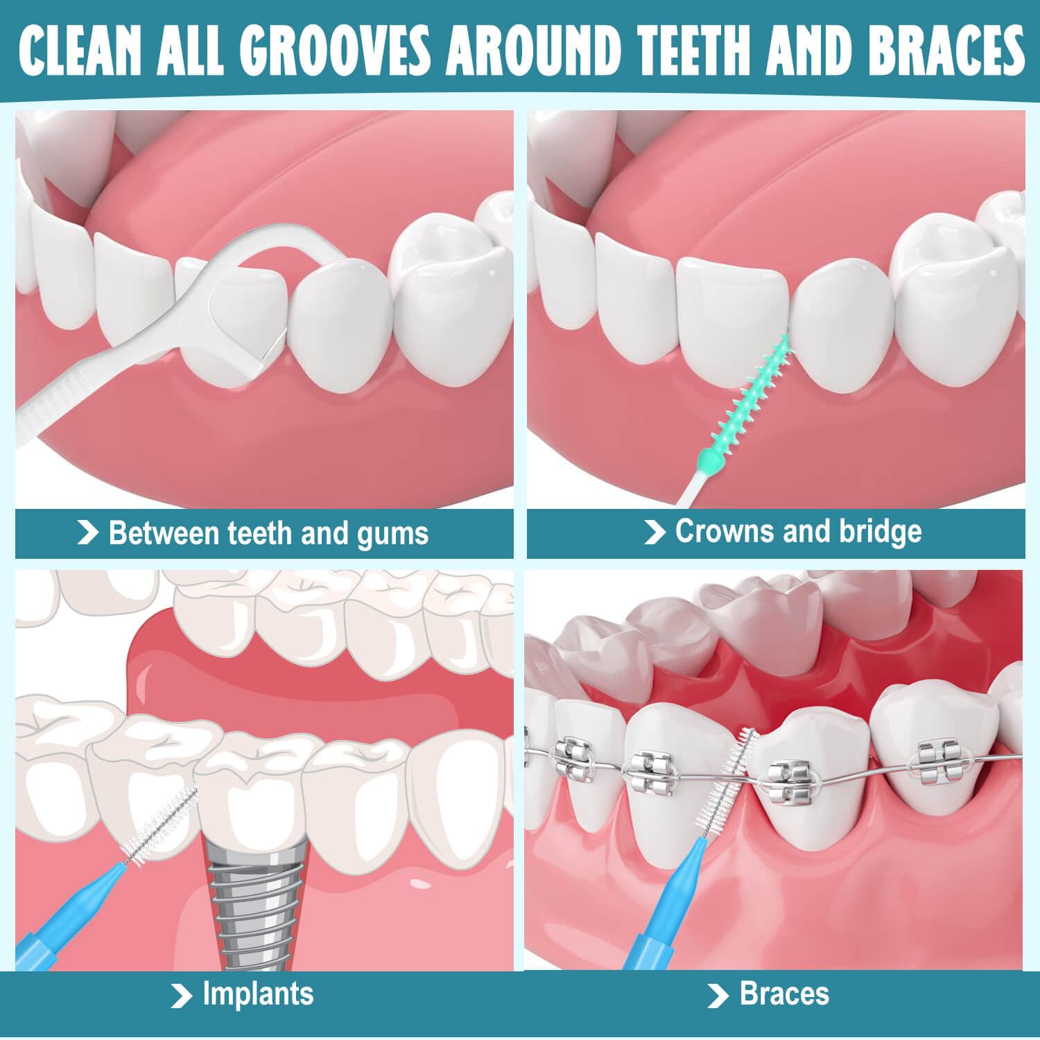 Lezmarket Juego de 450 cepillos interdentales y púas de hilo dental, cepillos de tirantes, púas suaves y varillas de hilo dental para dientes, cepillo limpiador de frenos, cepillo de hilo dental entre