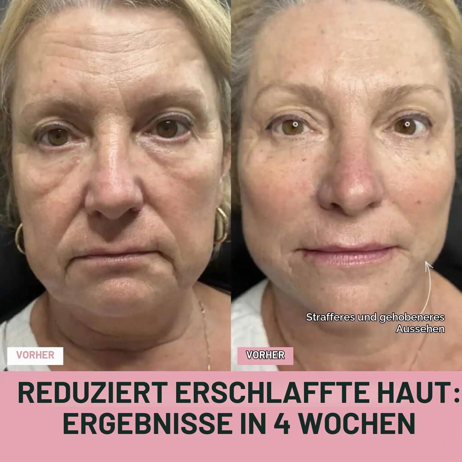 neurotex Kabelloses Nackenmassagegerät mit 6 Modi und 9 Intensitätsstufen, tragbares elektrisches Massagegerät mit 4 Kopf-Puls-Massage und Heizfunktion für Nackenentspannung