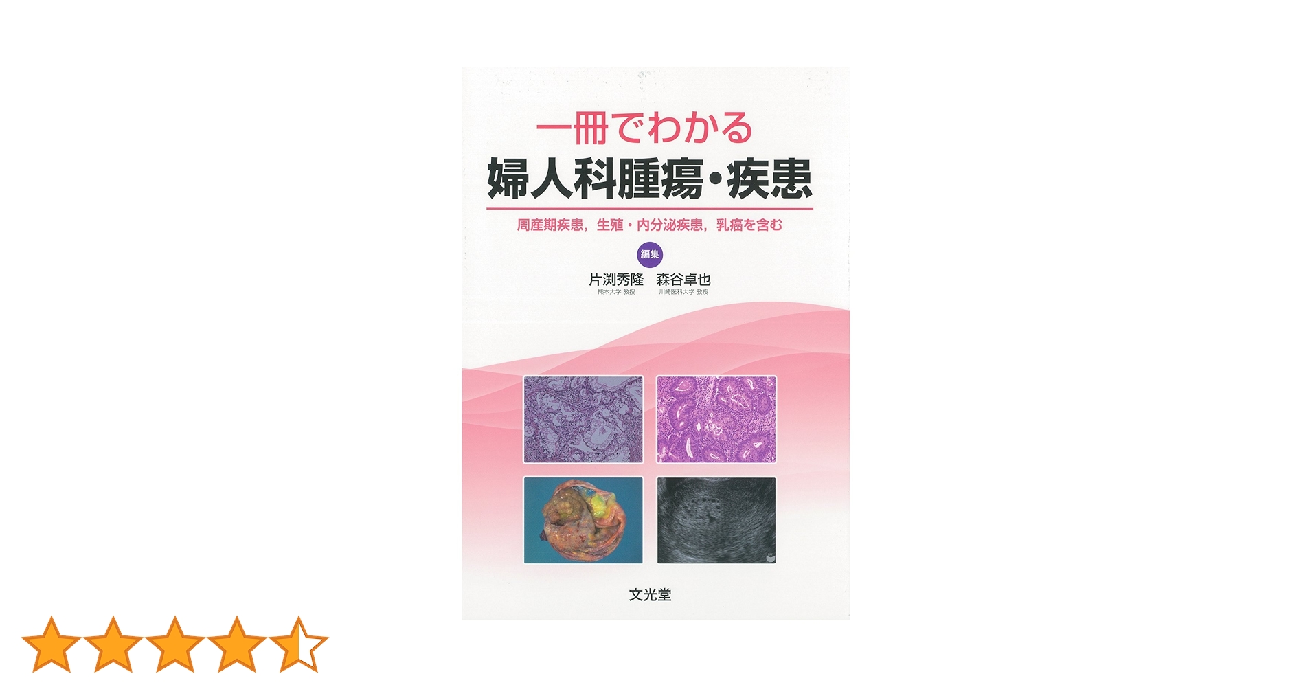 病理診断プラクティス 婦人科腫瘍 Amazon.co.jp: 婦人科腫瘍 (癌診療指針のための病理診断