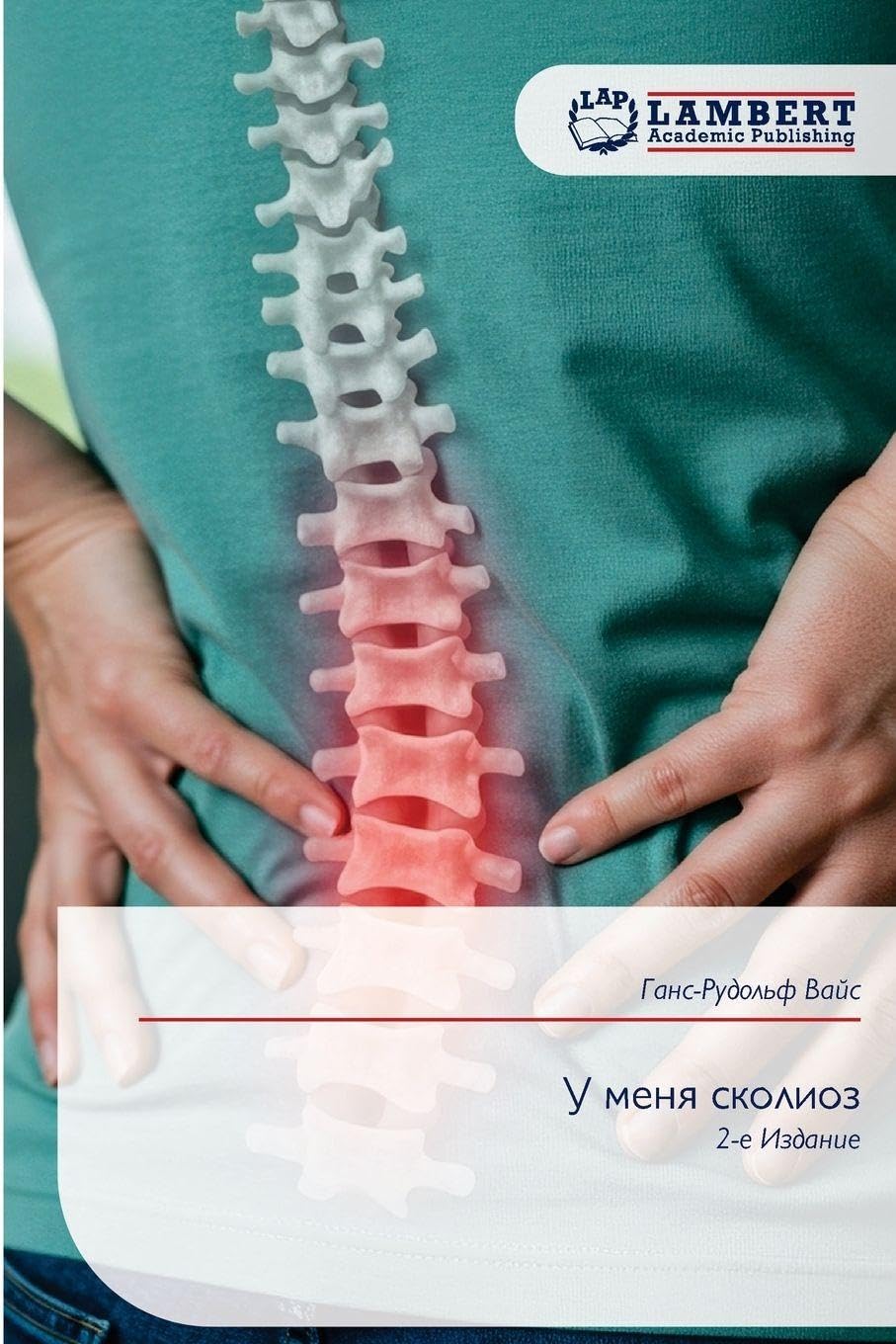 У меня сколиоз: 2-е Издание: 2-e Izdanie