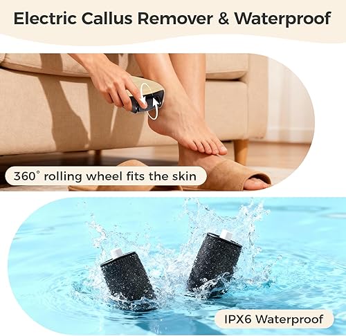 Miniatura 3 de QualityPinnacle Removedor de callos de pies, rodillo 3D patentado + 2 velocidades, LED, exfoliante de alta frecuencia de 30,000 RPM, portátil para