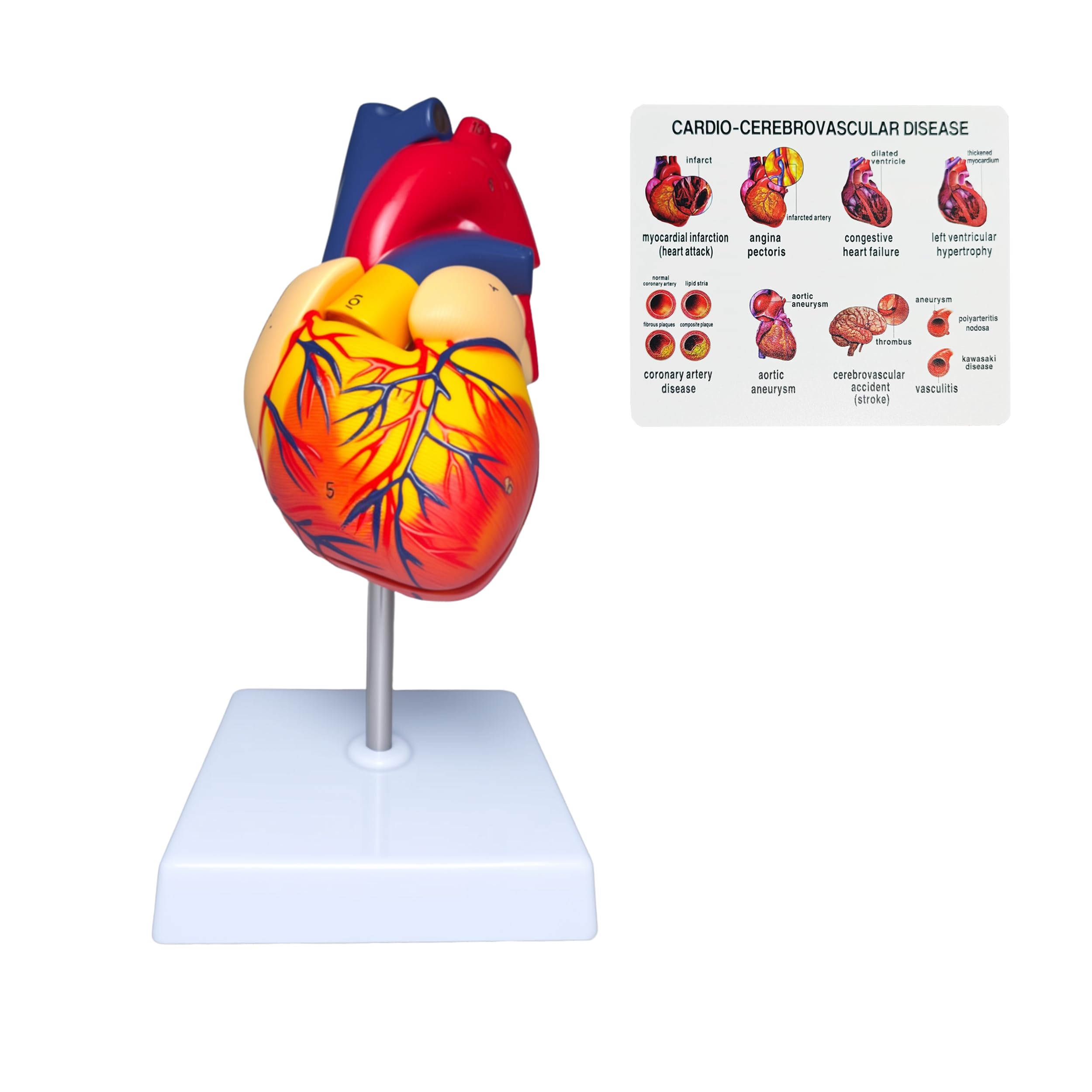 Rkakneecs Life Size Human Heart Model, 2-Part Detachable Anatomical Heart Medical Model, Anatomy with 34 Accurate Coded Structures, with Detailed