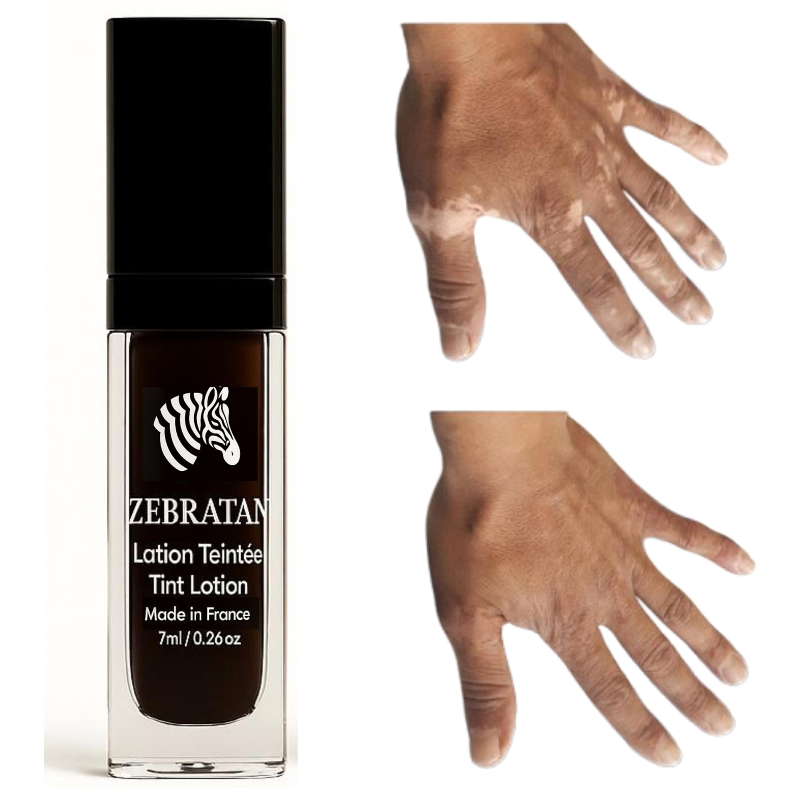 Lotion do makijażu bielactwa 7 ml – Maskuje białe plamy na skórze – Naturalny kamuflaż bez tłuszczu, nie podkład – Mężczyźni, Kobiety i Dzieci – Samoopalający, Wegański – Głęboki brązowy odcień