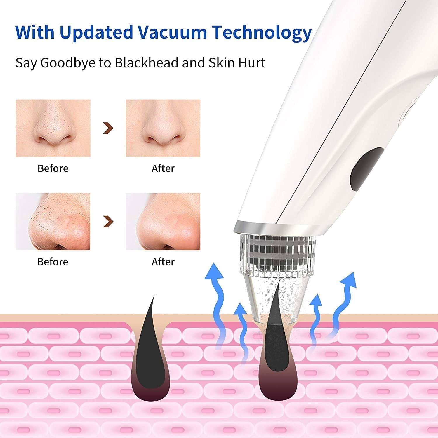 Blackhead Remover Pore Vacuum, Acne Comedone Tool, USB Rechargeable with LED Display, 5 Suction Power and Probes for Deep Cleaning