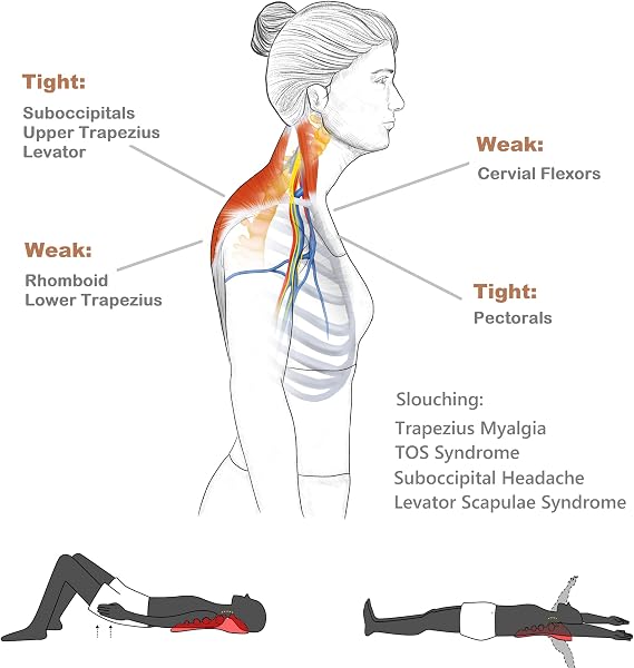 LittleMum Trapezius Trigger Point Massager. Myofasical Release Neck and Shoulder Pain, Suboccipital Release Tool, Posture Corrector, Relieve Upper Back Pain &Tension Headache