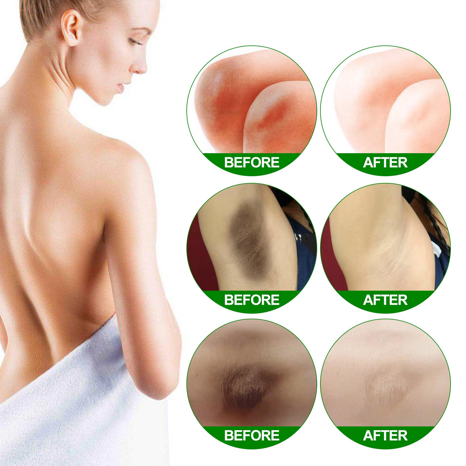 Underarm Whitening Cream Whitening Cream Skin Brightening Cream White Nourishes and Repairs Skin for Dark Skin Neck, Elbow, Knee Armpit - Image 4