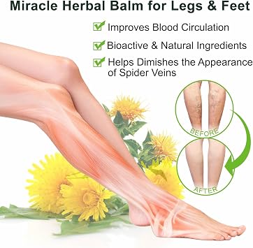 2 Pack Miracle Balm, Varicose Veins Treatment For Legs, Varicose Veins Cream - Muscle Soothing Body Creams - Instant Relief For Restless Legs, Vegan Natural Moisturiser For Skin Comfort