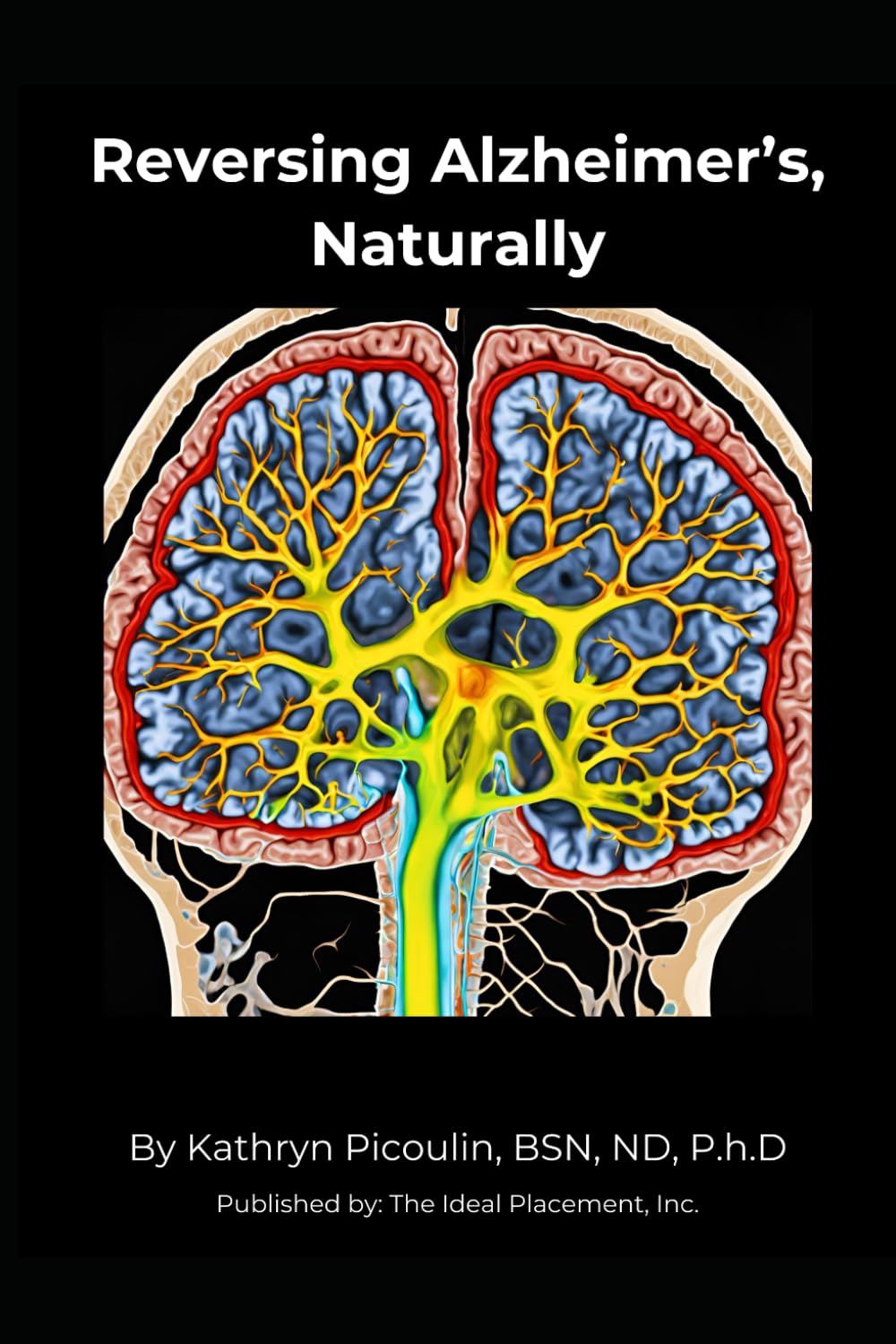 Reversing Alzheimer’s, Naturally