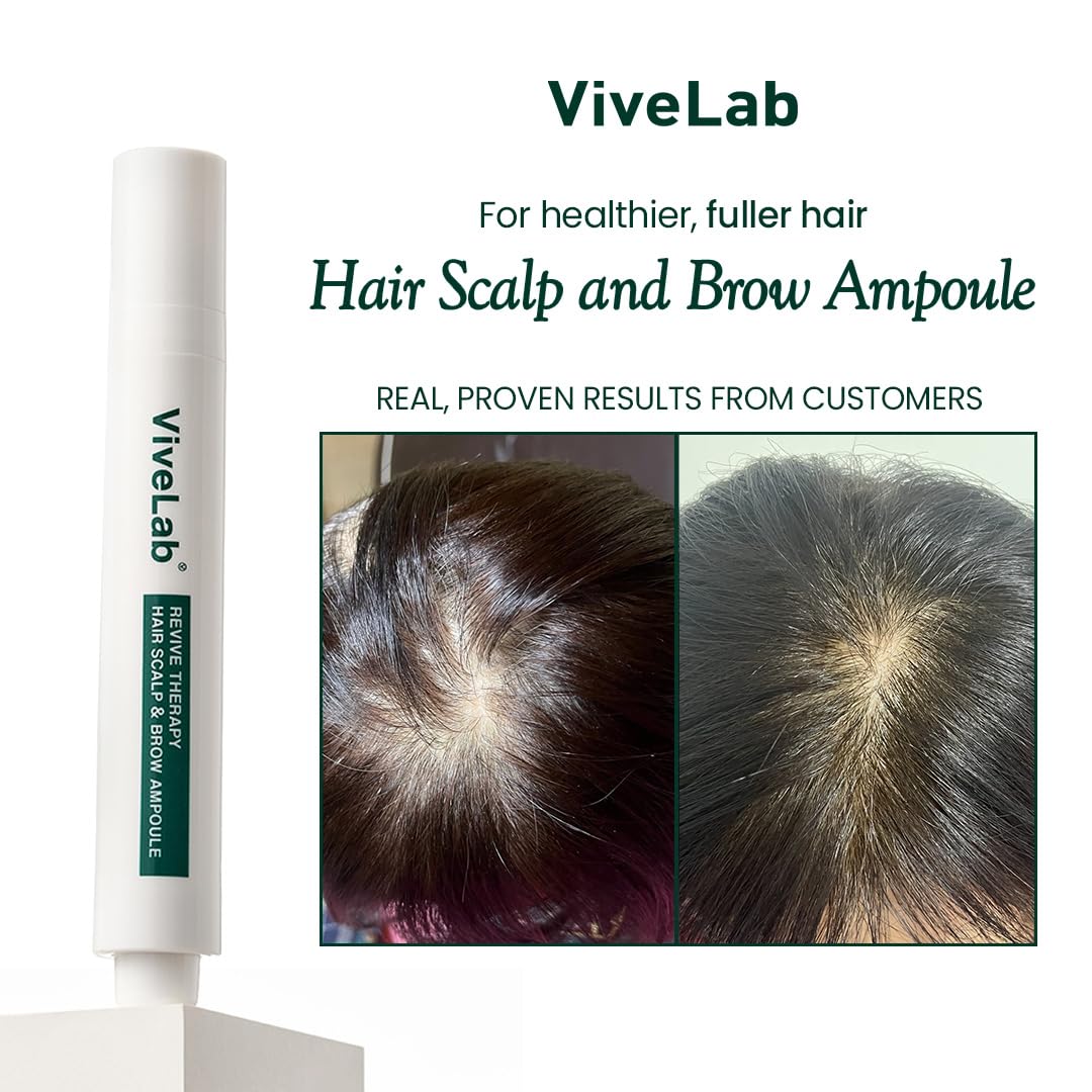 Scalp&Hair Serum for Thinning Hair by Vivelab,15ml–Clinically Tested,Nourishing Formula with Biotin,peptide. Promotes Healthy Scalp&Fuller-Looking Hair