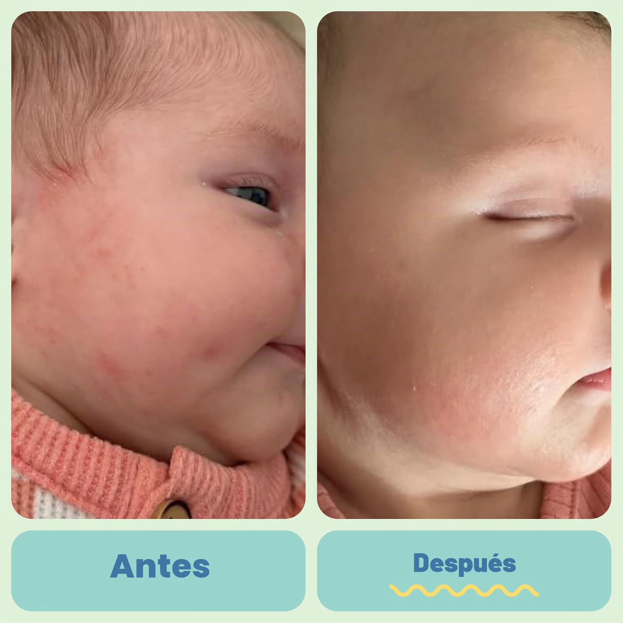 Tubby Todd All Over Ungüento para bebés, crema multiusos para eccema de bebé para piel sensible, piel seca, erupción cutánea, irritación, paquete de 2 unidades, 8 onzas, sin fragancia
