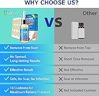 Vista 2 de Ulensy Removedor de Callos Líquido para Dedos de los Pies 20ml de Ácido Salicílico para Callos de los Pies, Eliminación de Verrugas en el Trabajo