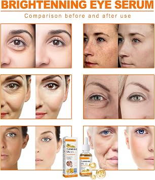Turmeric Oil Facial Serum, Turmeric Spot Correcting Serum & Illuminating Serum, improves dullness, diminishes spots, improves skin tone, moisturises and illuminates, suitable for all skin type (10ML)