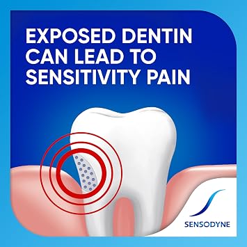 Sensodyne Extra Whitening Toothpaste, 2.7 Ounces (Pack of 2)