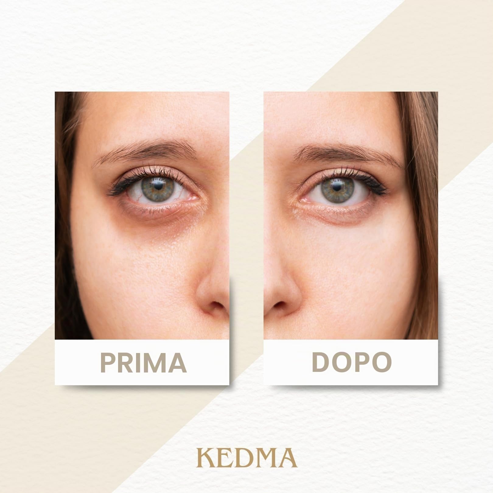 KEDMA - Duo Lifting Contorno Occhi con Siero & Crema - 30ml+50g | Il duo occhi combina un siero lifting e una crema idratante per levigare e rivitalizzare il contorno occhi.