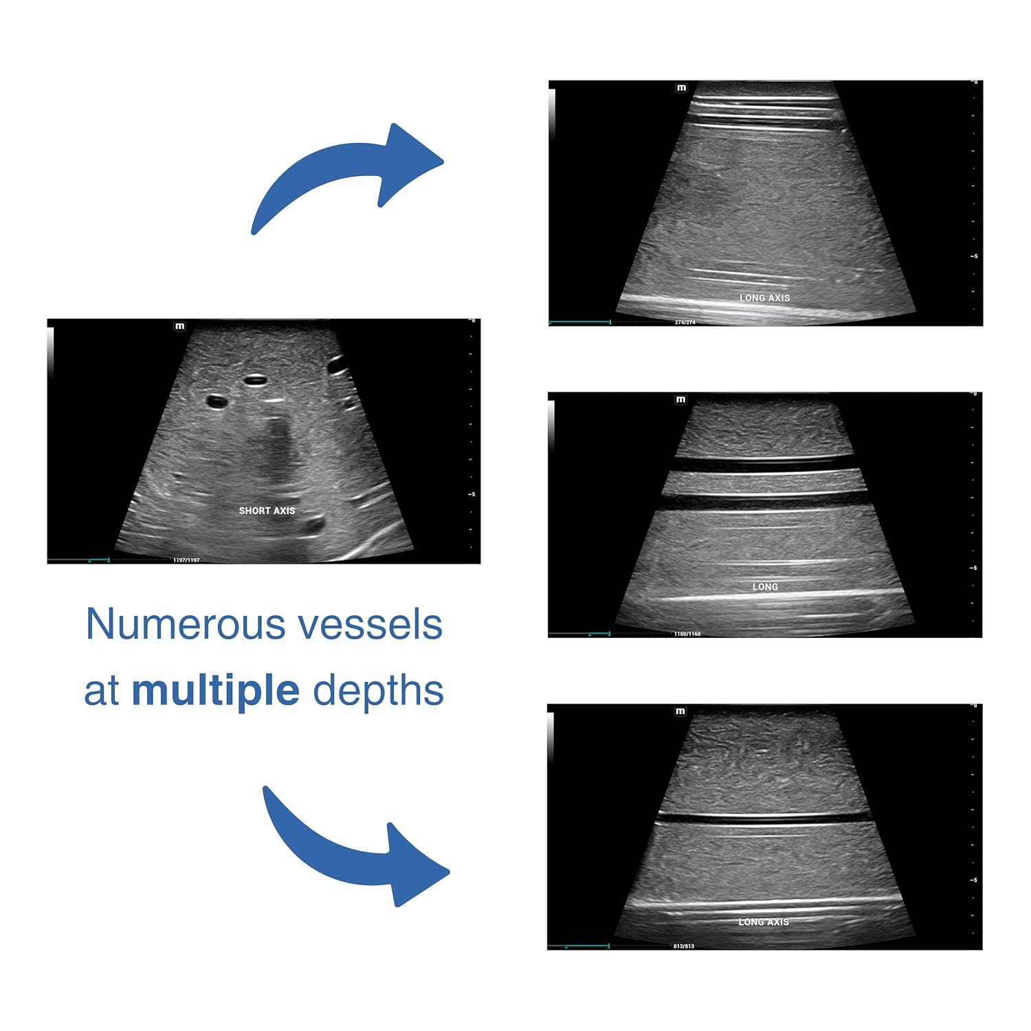 Ultrasound Vascular Access Phantom – Arm Model for IV and Catheter Training