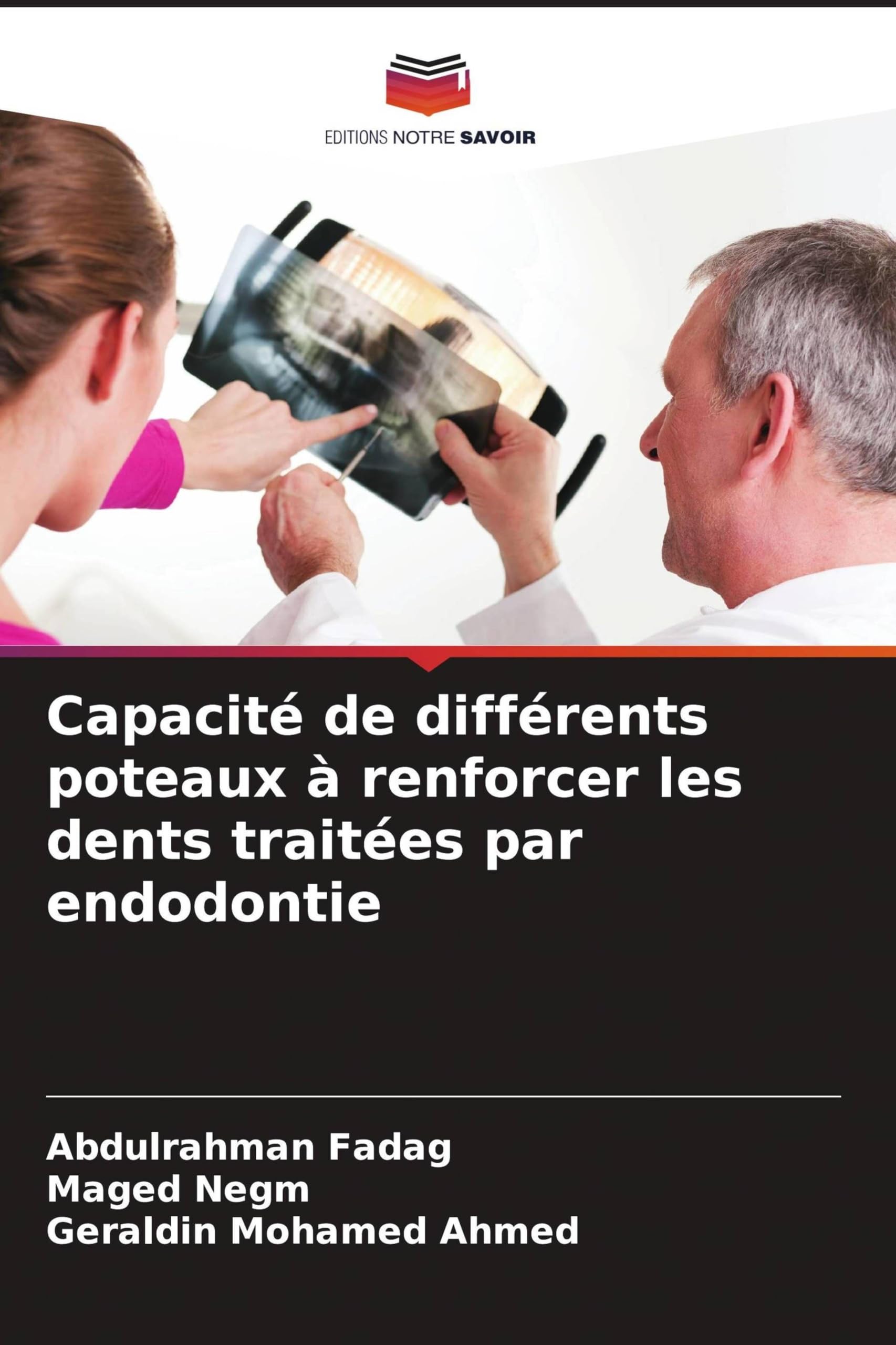 Capacité de différents poteaux à renforcer les dents traitées par endodontie