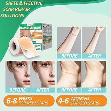 Medical Grade Silicone Scar Tape, 1.6x 120 Easy-Tear Roll-3M | Silicone Scar Sheets for C-Section and Surgery, Skin Tape of Keloid Bump Removal Strips for Postpartum Moms Burn & Injury