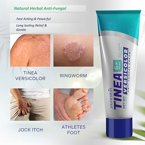 Miniatura 5 de Tinea Versicolor Crema Antifúngica Tratamiento Antifúngico Natural Extra Strength - para tiña Versicolor Tiña Pie de Atleta