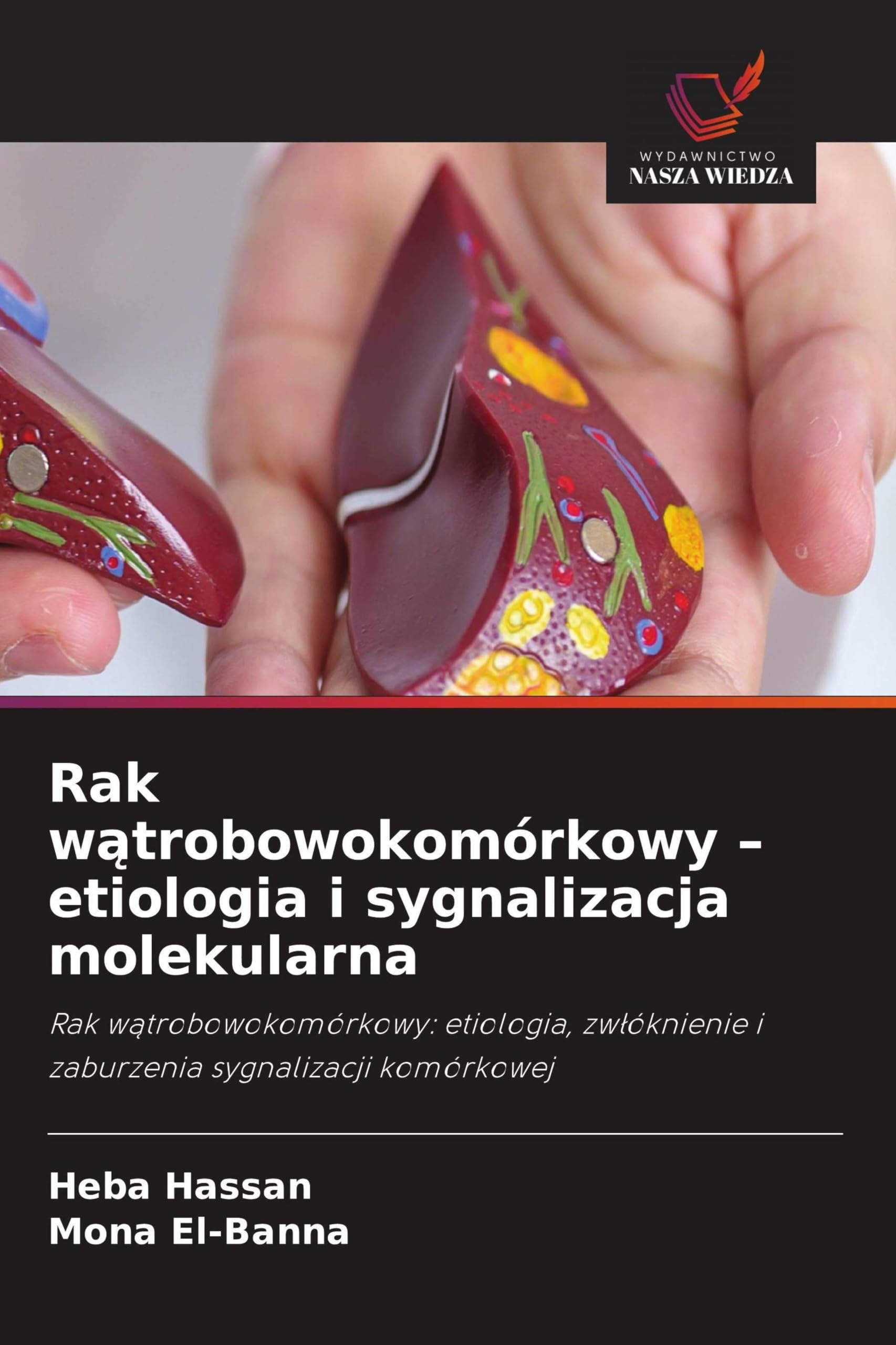Rak w¿trobowokomórkowy - etiologia i sygnalizacja molekularna: Rak w¿trobowokomórkowy: etiologia, zw¿óknienie i zaburzenia sygnalizacji komórkowej