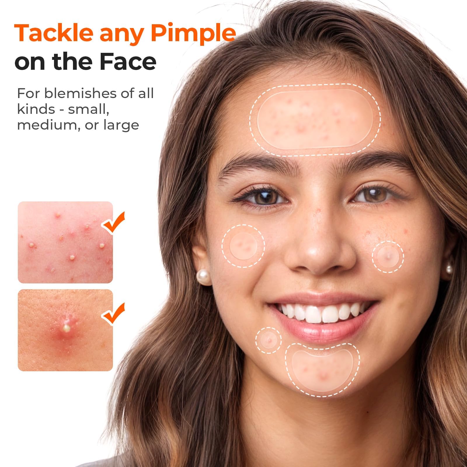TKTK 443 Count Pimple Patches for Face, Hydrocolloid Acne Patch Bulk, Acne Stickers for Covering Cheeks, Forehead, Chin Blemishes Zit Breakouts for All Skin Types (Dots, Strip, Contoured 5 Sizes) — view 3
