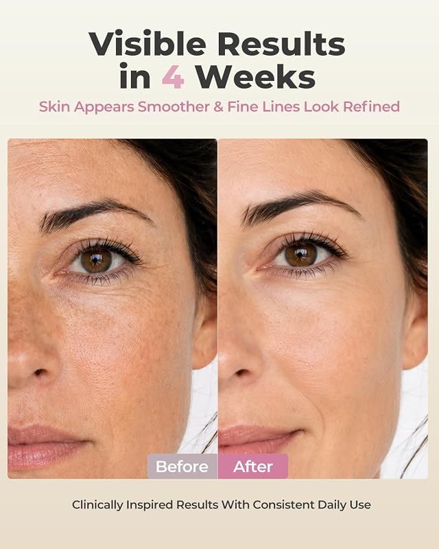 Red Light Therapy Mask for Face, Fine Lines, Acne & Radiance image 5