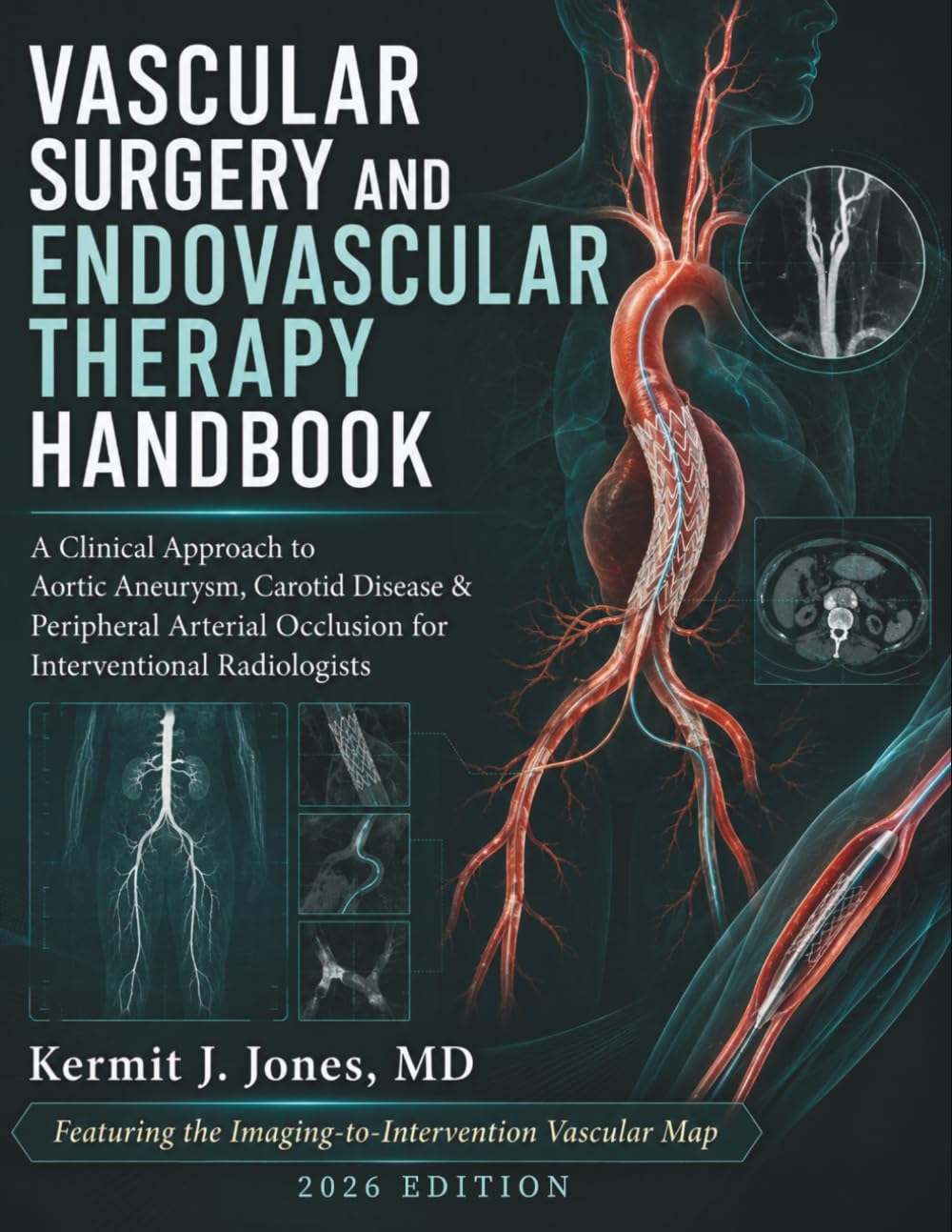 Vascular Surgery and Endovascular Therapy Handbook: A Clinical Approach to Aortic Aneurysm, Carotid Disease & Peripheral Arterial Occlusion for Interventional Radiologists