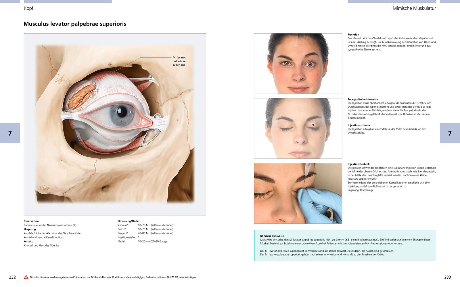 Atlas der Botulinumtoxin-Injektion: Dosierung | Lokalisation | Anwendung