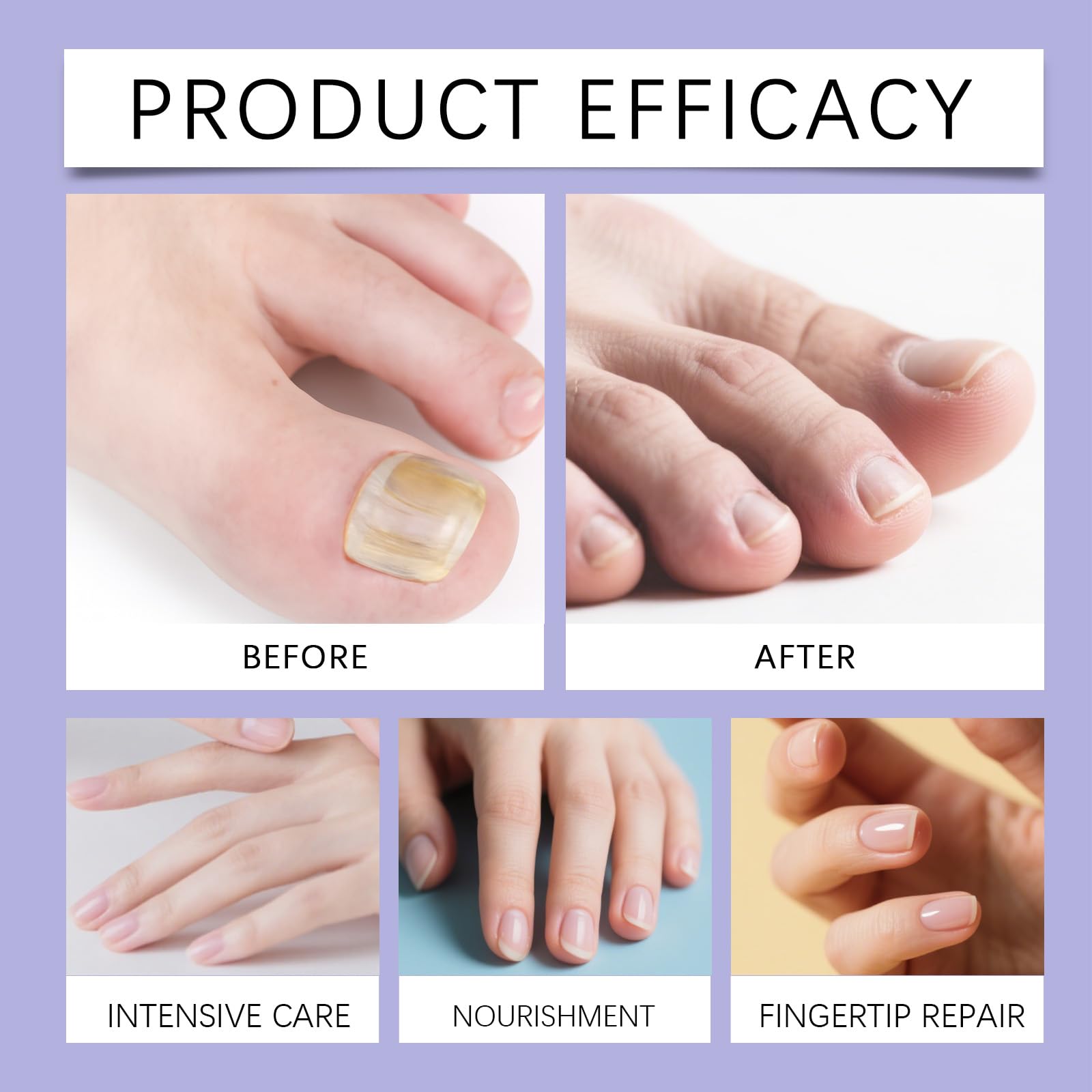 Nagelhärter für schwache und beschädigte Nägel, Nagelhautöl mit Keratin-Aminosäure-Formel, extra starker Härter und Nagelwachstums-Politur, tägliches stärkendes, pflegendes (10pcs)