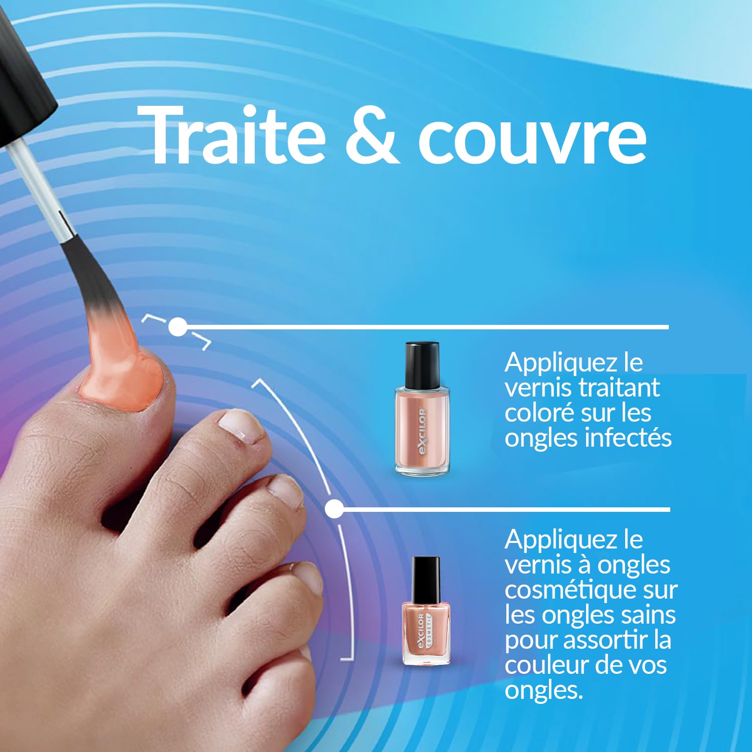 EXCILOR - Forte Color - Trattamento della micosi dell'unghia - Tratta e copre - Trattamento 30 ml + Smalto cosmetico per unghie da 8 ml - Clinicamente provato* - Nude