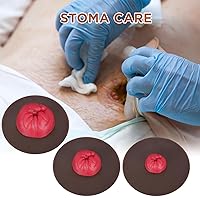 Vista 6 de Simuladores de colostomía pegajosa, juego de modelos de entrenamiento de estoma, modelos de práctica de cuidado de ostomía de varios tonos de piel