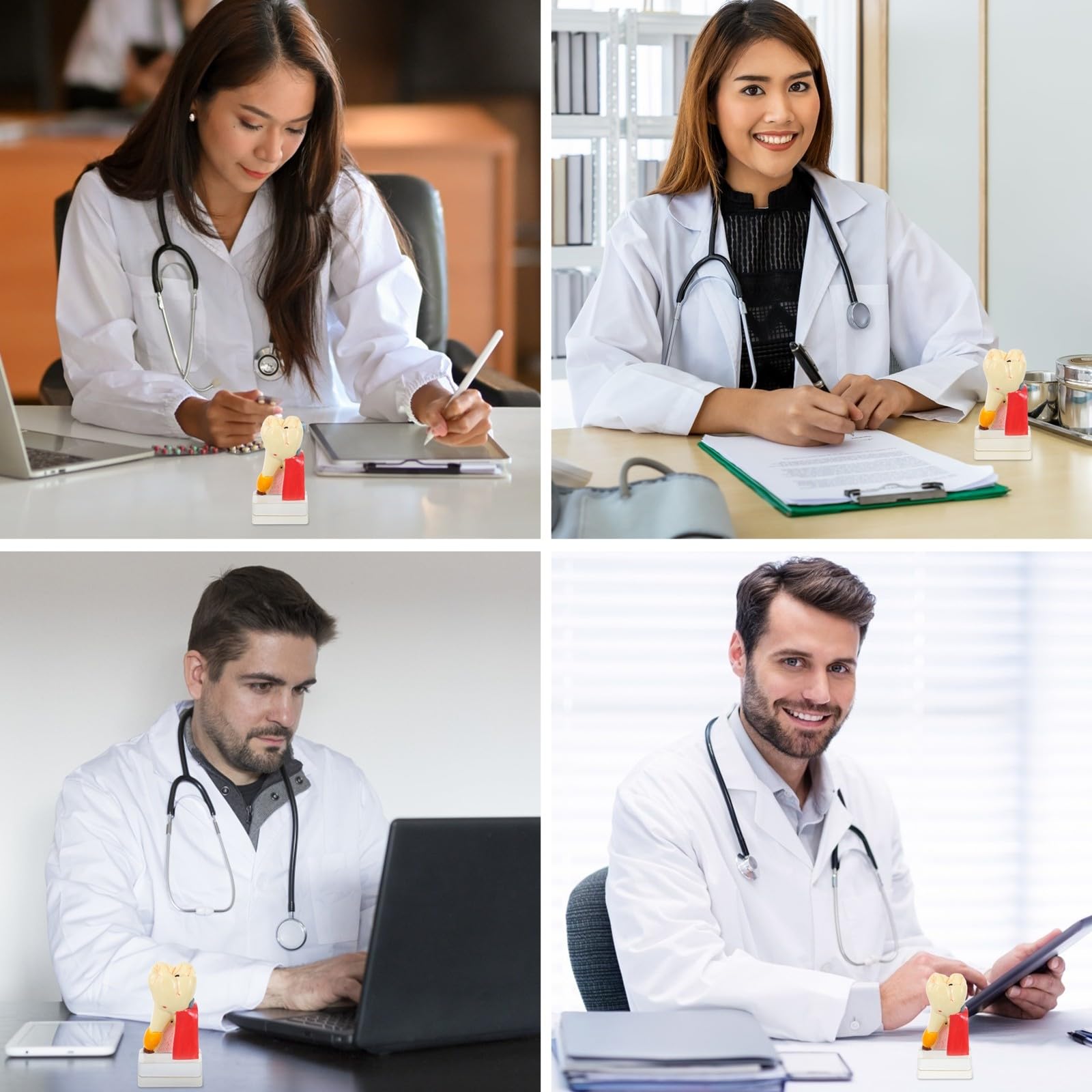 Zerodeko Modèle Anatomique de Carie Dentaire Beige en Résine Portable pour Démonstration Professionnelle des Soins Dentaires par Dentistes
