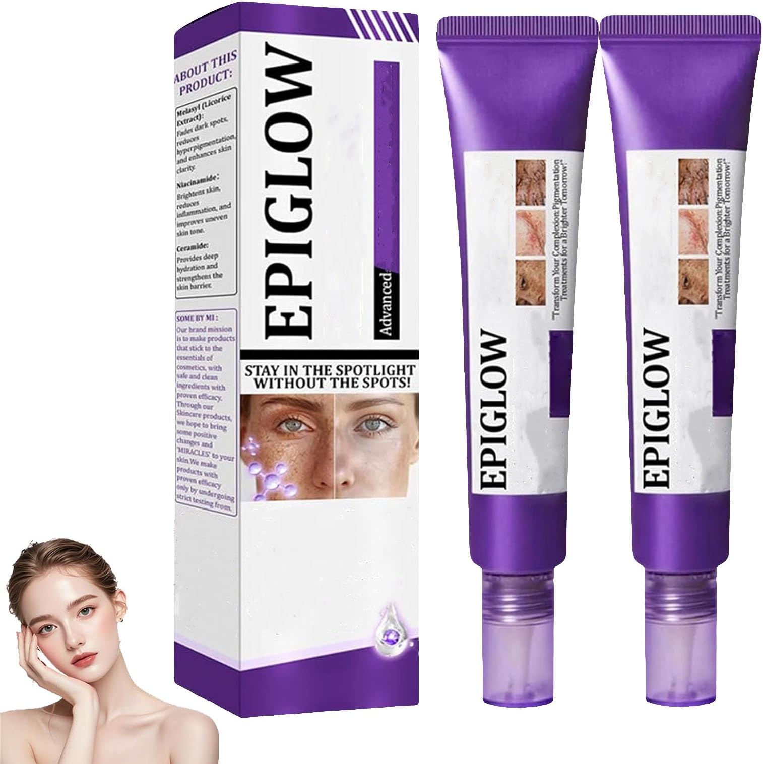 EPIGLOW MelanEX Advanced pigmentation Cream, Tone Correcting Moisturizer, EPIGLOW Cream For pigmentation Treatment, Anti-Aging Face, Dark Spots Remover,Skin Brightening Cream𝐫 (2PCS)