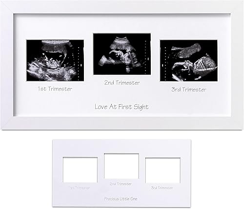 eletecpro Marco de fotos de ultrasonido, para pantalla de fotos de ecografía de 3 x 4, marcos de fotos de sonograma para anuncio de embarazo,