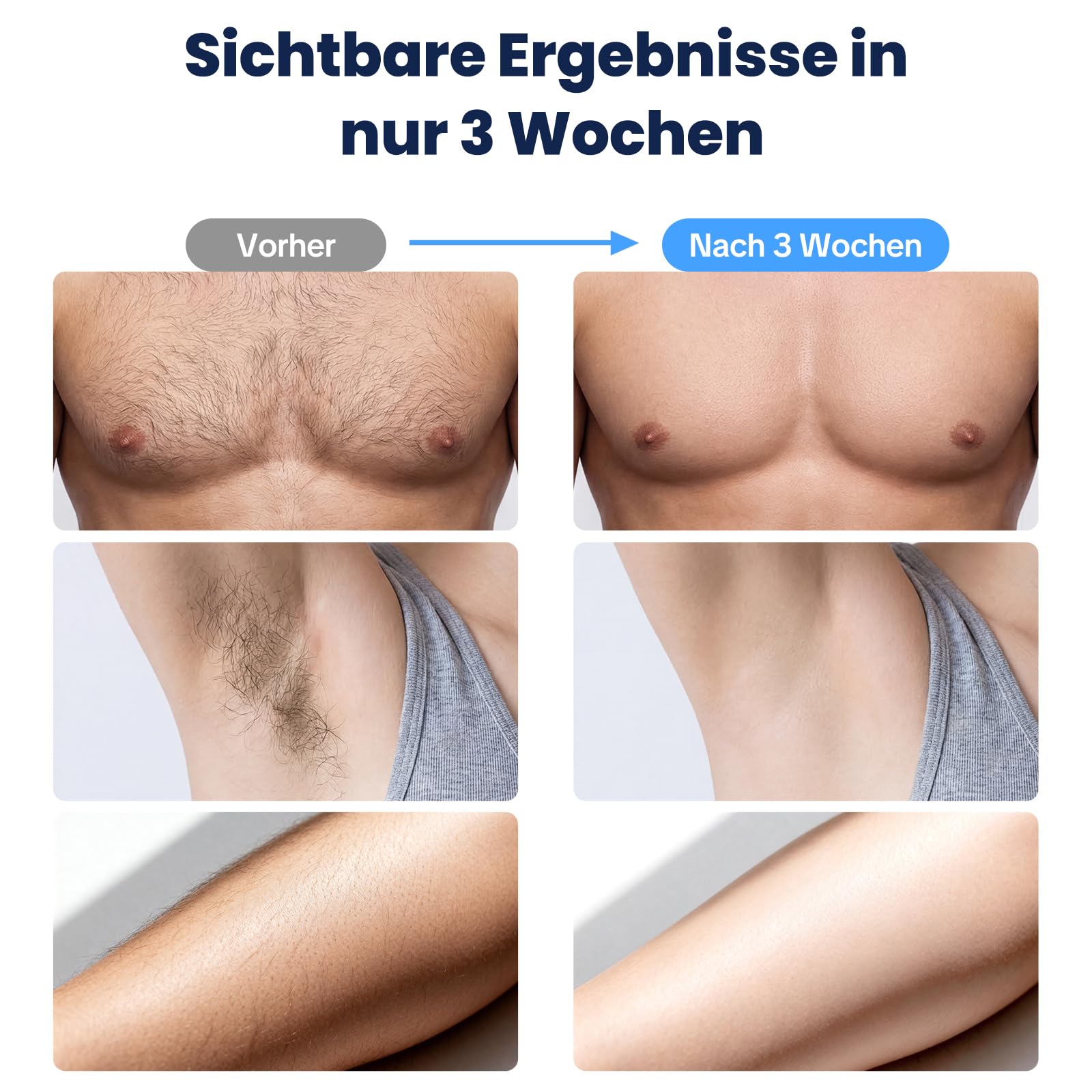 MANKIW IPL Geräte Haarentfernung mit Kühlfunktion, 5 Energiestufen & 500.000 Lichtimpulse, Automatik- & Einzelmodus, Laser Haarentfernung Alternative, Epilierer Damen für Beine, Achseln & Bikini