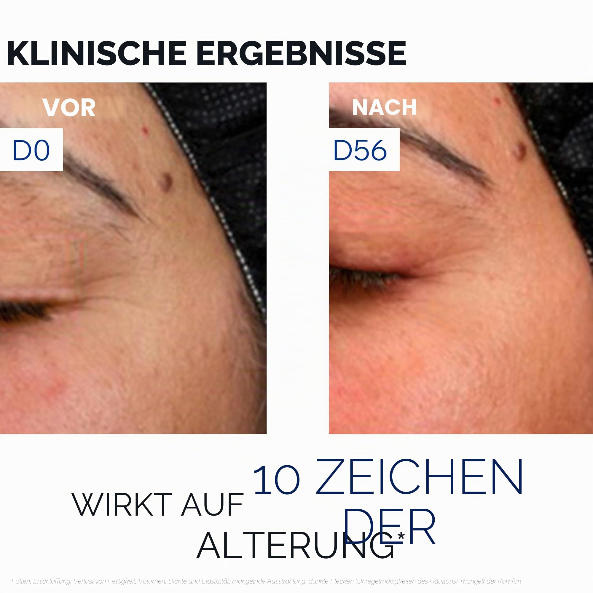 Uriage Age Absolu Collagen Booster Serum Mikro - verdichtendes Serum mit Procollagen Peptiden & Retinol, Sofortiger Plumping-Effekt, X6 Collagen Booster - Falten, Ausstrahlung, Volumen - 30ml