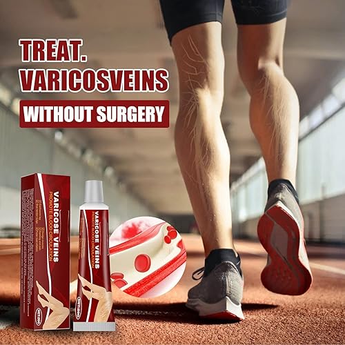 Miniatura 5 de Crema para venas varicosas, 0.71 oz, crema para tratamiento de venas varicosas, pomada para aliviar las venas