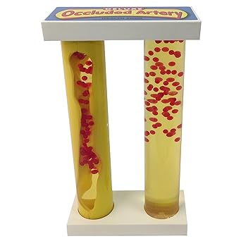WRS Group, Health Edco 79153 Deluxe Occluded Artery Model