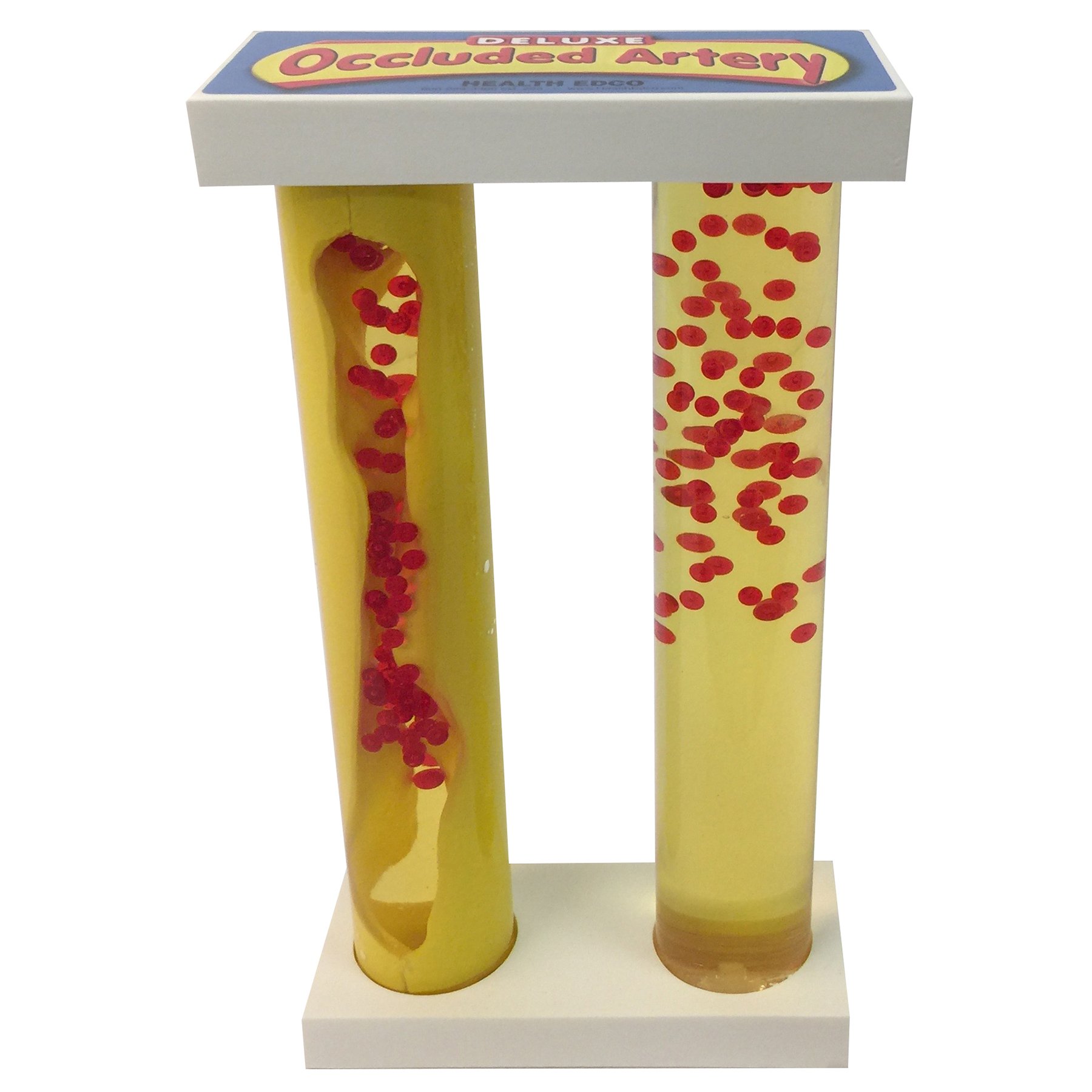 WRS Group, Health Edco 79153 Deluxe Occluded Artery Model
