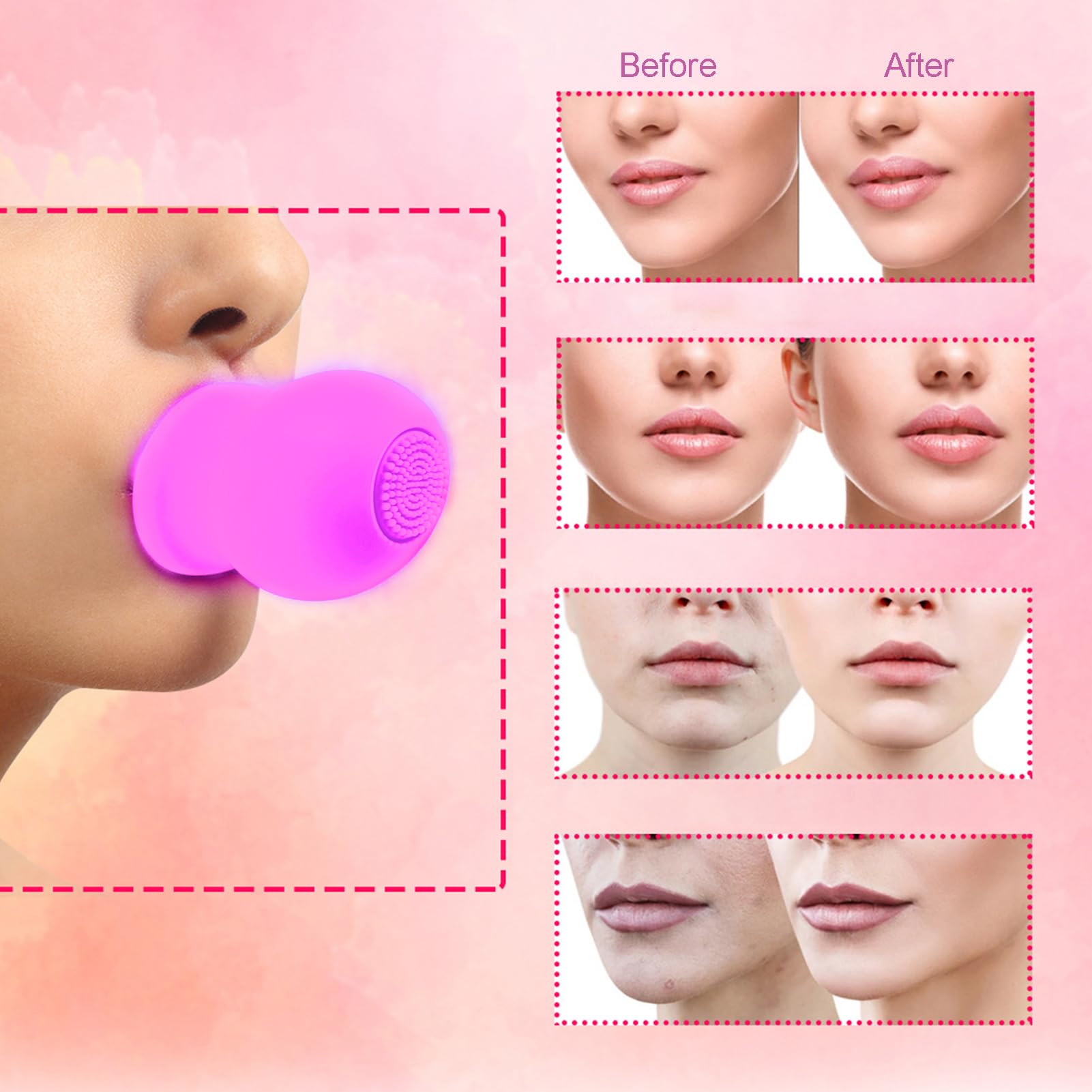 Bomba de Labios de Silicona 2 Colores para Masaje Facial con Cepillo