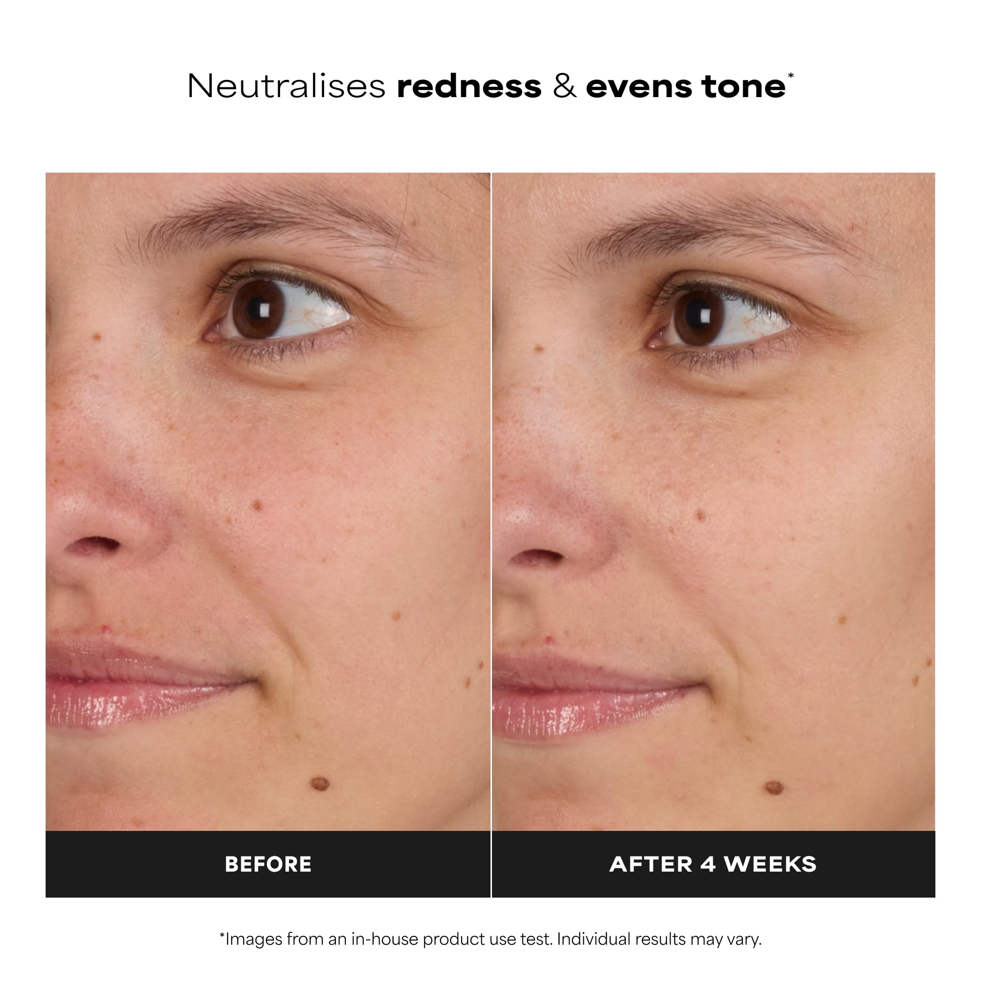 Paula's Choice SKIN BALANCING Tonik - Delikatnie Nawilżający Tonik do Twarzy Zmniejszające Rozszerzone Pory & Zwalczanie Wyprysków i Zaskórników - z Niacynamid - Skóra Mieszana i Tłusta - 190 ml | Lekki krem nawilżający zwalcza niedoskonałości i zaskórnik