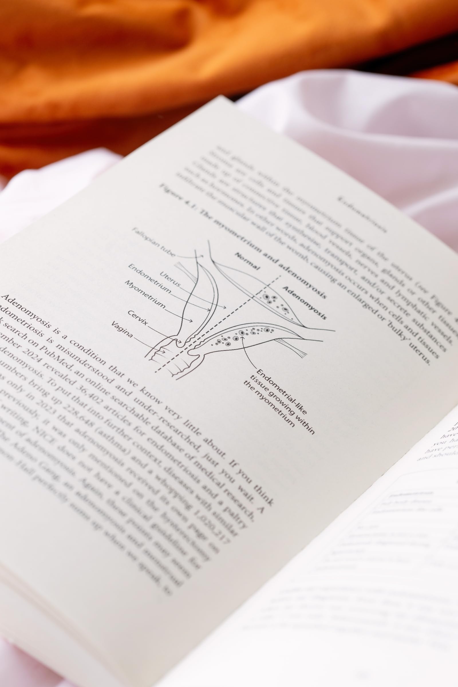 Endometriosis: Understand your symptoms, get the right treatment, reclaim your life