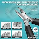 Nail Clipper Set for Adult Ingrown Toenails, RONAVO Heavy Duty Toe Nail Clippers Seniors Thick Nails Long Handle, Large Toenail Clippers for Ingrown Nails 4Pcs（Black） gallery image