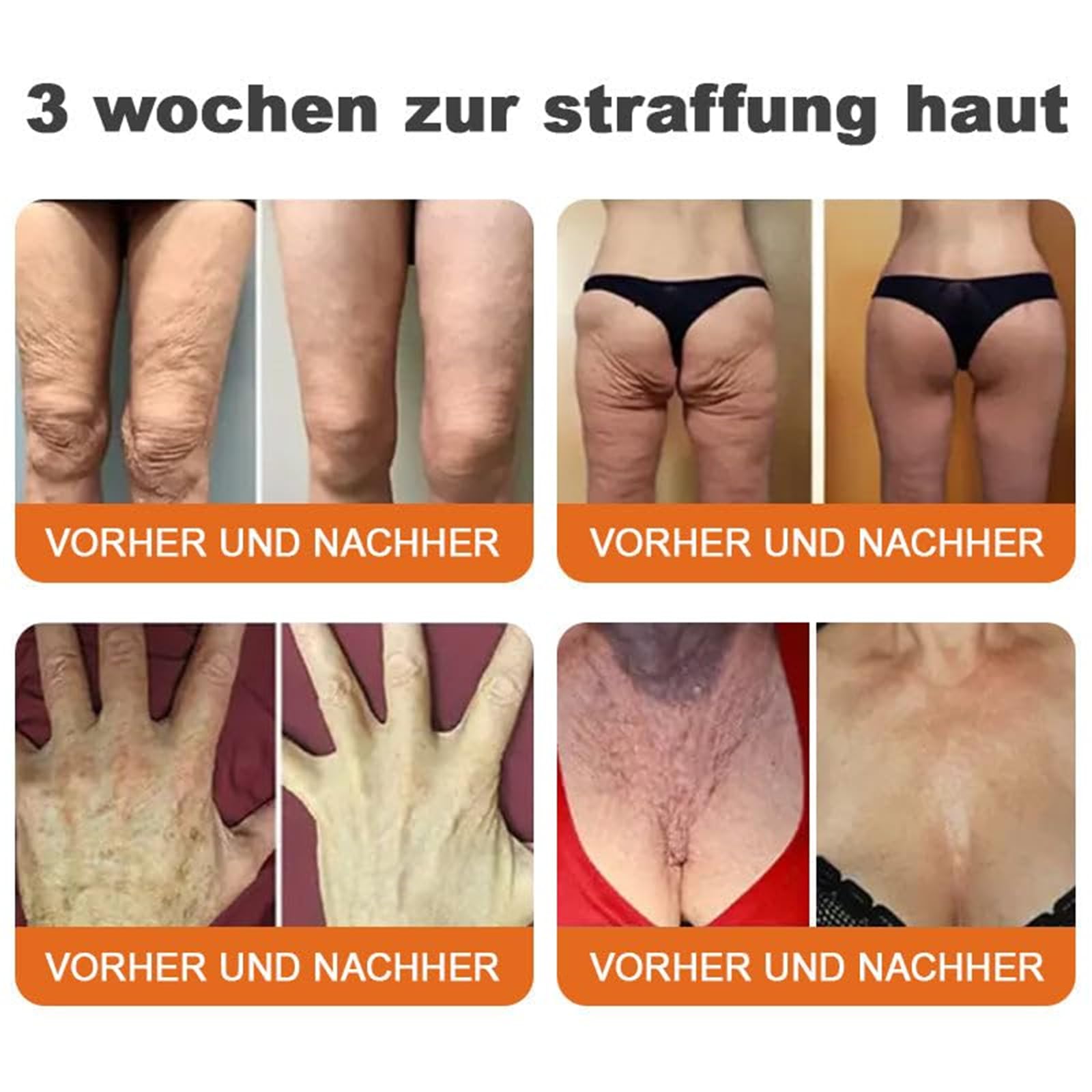 Spzv Bienengift StraffendeSerum Stick, Fortschrittliches Bienengift Straffende Creme Hautfeuchtigkeit, Spzv Bienengift Stick Sanfte Faltenentfernung für jeden Hauttyp (1)