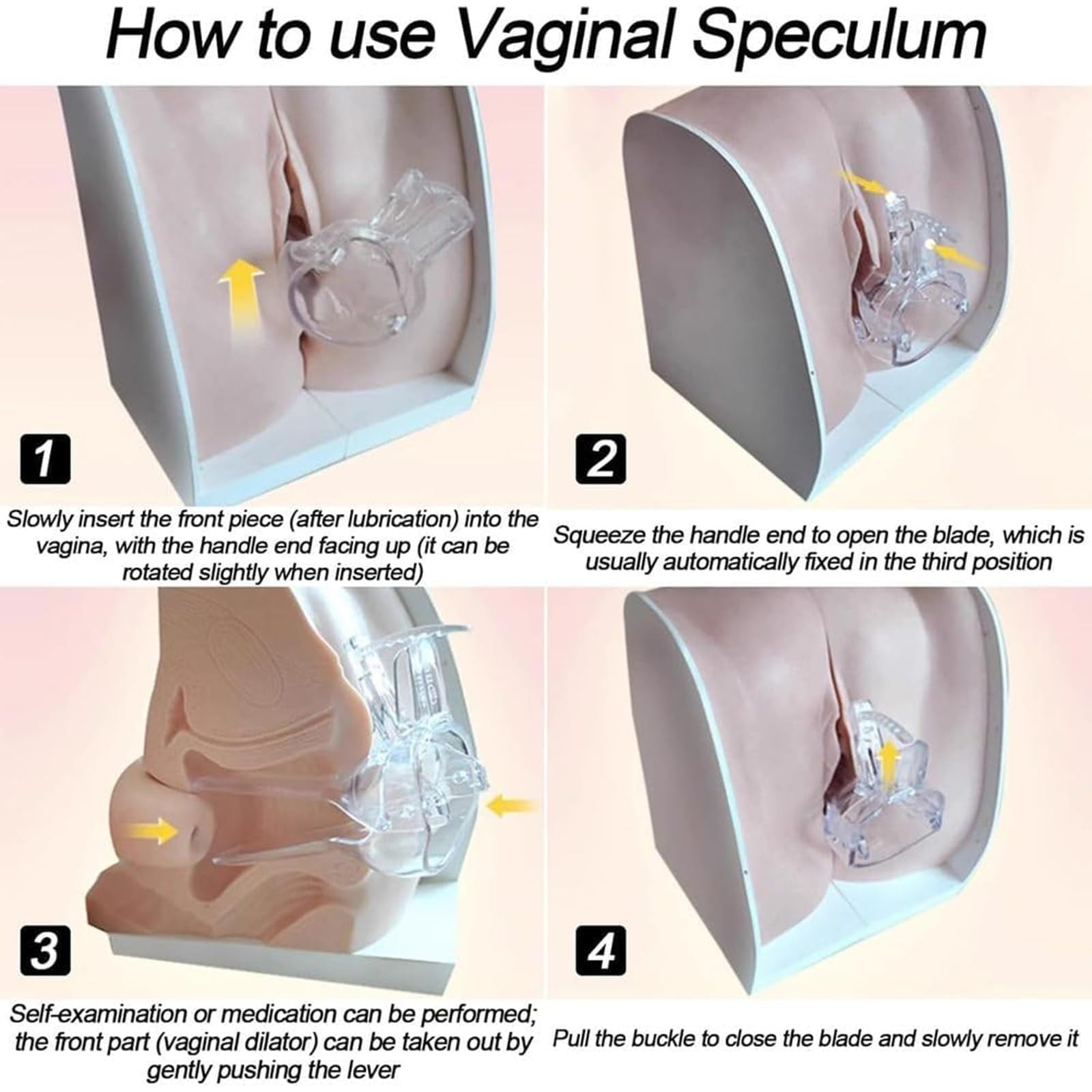 Modello Didattico di Contraccezione Femminile, Modello di Anatomia Genitale Ginecologica per la Guida alla Contraccezione e l'Educazione Medica